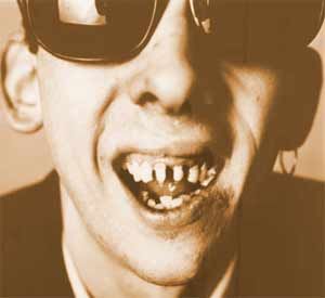 http://i1143.photobucket.com/albums/n627/thedogcody/shane_mcgowan_teeth.jpg