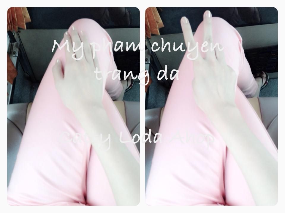 Thay da sinh học axit trái cây siêu trắng - bao trắng bóc 1000% - bong 1 lớp - 1